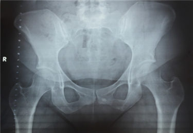 知っておきたい、妊娠と骨盤の関係